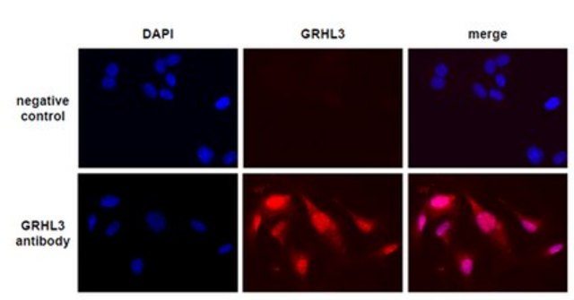 Anti-Grainyhead-Like 3/GRHL3 Antibody from rabbit, purified by affinity chromatography