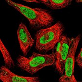 Anti-FOXK2 antibody produced in rabbit Prestige Antibodies® Powered by Atlas Antibodies, affinity isolated antibody, buffered aqueous glycerol solution