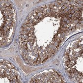 Anti-FLVCR2 antibody produced in rabbit Prestige Antibodies® Powered by Atlas Antibodies, affinity isolated antibody, buffered aqueous glycerol solution