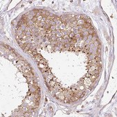 Anti-DNM2 antibody produced in rabbit Prestige Antibodies® Powered by Atlas Antibodies, affinity isolated antibody, buffered aqueous glycerol solution