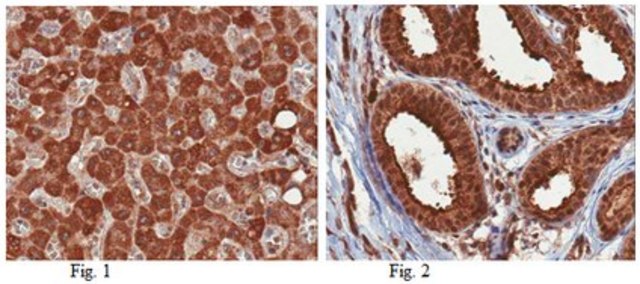Anti-HepaCAM-1 Antibody from rabbit, purified by affinity chromatography