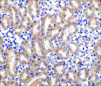 Anti-DCR2 antibody produced in rabbit affinity isolated antibody, buffered aqueous solution