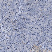 Anti-RGS10 antibody produced in rabbit Prestige Antibodies® Powered by Atlas Antibodies, affinity isolated antibody, buffered aqueous glycerol solution