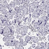 Anti-CRX antibody produced in rabbit Prestige Antibodies® Powered by Atlas Antibodies, affinity isolated antibody, buffered aqueous glycerol solution