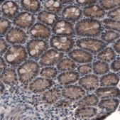 Monoclonal Anti-PGM1 antibody produced in mouse Prestige Antibodies® Powered by Atlas Antibodies, clone CL3301, purified immunoglobulin