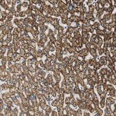 Anti-ALDH4A1 antibody produced in rabbit Prestige Antibodies® Powered by Atlas Antibodies, affinity isolated antibody, buffered aqueous glycerol solution