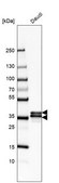 Anti-HNRNPA2B1 antibody produced in rabbit Prestige Antibodies® Powered by Atlas Antibodies, affinity isolated antibody