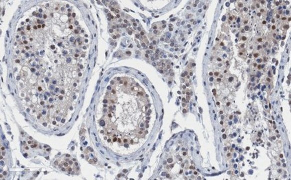 Anti-Daxx Antibody, clone Daxx5.14 clone DAXX5.14, from mouse
