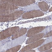 Anti-MYLPF Prestige Antibodies® Powered by Atlas Antibodies, affinity isolated antibody