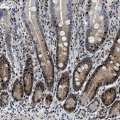 Anti-TOX antibody produced in rabbit Prestige Antibodies® Powered by Atlas Antibodies, affinity isolated antibody, buffered aqueous glycerol solution