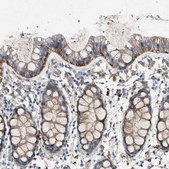 Anti-PTGFRN antibody produced in rabbit Prestige Antibodies® Powered by Atlas Antibodies, affinity isolated antibody, buffered aqueous glycerol solution