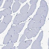 Anti-MYLK antibody produced in rabbit Prestige Antibodies® Powered by Atlas Antibodies, affinity isolated antibody, buffered aqueous glycerol solution
