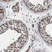 Anti-ZNHIT1 antibody produced in rabbit Prestige Antibodies® Powered by Atlas Antibodies, affinity isolated antibody, buffered aqueous glycerol solution