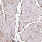 Anti-CHMP1B antibody produced in rabbit Prestige Antibodies® Powered by Atlas Antibodies, affinity isolated antibody, buffered aqueous glycerol solution