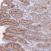 Anti-ABHD8 antibody produced in rabbit Prestige Antibodies® Powered by Atlas Antibodies, affinity isolated antibody, buffered aqueous glycerol solution