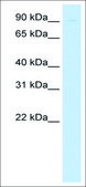 Anti-SIRT1 antibody produced in rabbit affinity isolated antibody