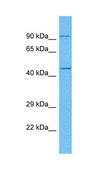 Anti-E2F3 antibody produced in rabbit affinity isolated antibody