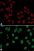 Anti-Lamin A (C-terminal) antibody produced in rabbit ~1 mg/mL, affinity isolated antibody, buffered aqueous solution