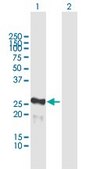 Anti-MIS12 antibody produced in mouse IgG fraction of antiserum, buffered aqueous solution
