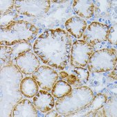 Anti-MAP2K1 antibody produced in rabbit