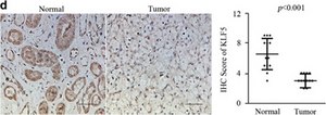 Anti-KLF5 antibody produced in rabbit Prestige Antibodies® Powered by Atlas Antibodies, affinity isolated antibody, buffered aqueous glycerol solution