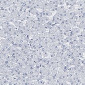 Anti-GNAS antibody produced in rabbit Prestige Antibodies® Powered by Atlas Antibodies, affinity isolated antibody, buffered aqueous glycerol solution