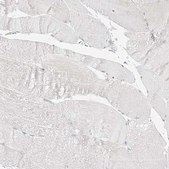 Anti-TRANK1 antibody produced in rabbit Prestige Antibodies® Powered by Atlas Antibodies, affinity isolated antibody, buffered aqueous glycerol solution