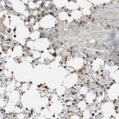 Anti-USP20 antibody produced in rabbit Prestige Antibodies® Powered by Atlas Antibodies, affinity isolated antibody, buffered aqueous glycerol solution