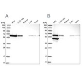 Anti-ERO1A antibody produced in rabbit Prestige Antibodies® Powered by Atlas Antibodies, affinity isolated antibody, buffered aqueous glycerol solution