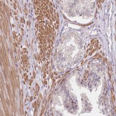 Anti-SMPD4 antibody produced in rabbit Prestige Antibodies® Powered by Atlas Antibodies, affinity isolated antibody, buffered aqueous glycerol solution