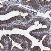Anti-BTN3A3 antibody produced in rabbit Prestige Antibodies® Powered by Atlas Antibodies, affinity isolated antibody, buffered aqueous glycerol solution