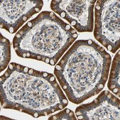 Anti-VAPB antibody produced in rabbit Prestige Antibodies® Powered by Atlas Antibodies, affinity isolated antibody, buffered aqueous glycerol solution