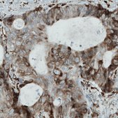 Monoclonal Anti-MTDH antibody produced in mouse Prestige Antibodies® Powered by Atlas Antibodies, clone CL0397, purified immunoglobulin, buffered aqueous glycerol solution