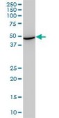 Monoclonal Anti-STCH, (C-terminal) antibody produced in mouse clone 1H8, purified immunoglobulin, buffered aqueous solution