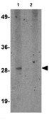 Anti-SYPL1 Antibody from rabbit, purified by affinity chromatography