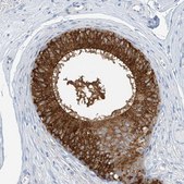 Anti-RCN2 antibody produced in rabbit Prestige Antibodies® Powered by Atlas Antibodies, affinity isolated antibody, buffered aqueous glycerol solution