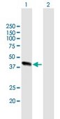 Anti-ALDOB antibody produced in mouse purified immunoglobulin, buffered aqueous solution