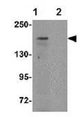 Anti-ATP2C1 Antibody from rabbit, purified by affinity chromatography