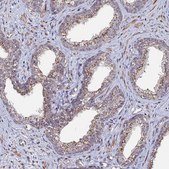 Anti-SGMS1 antibody produced in rabbit Prestige Antibodies® Powered by Atlas Antibodies, affinity isolated antibody, buffered aqueous glycerol solution