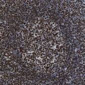 Anti-RBL2 antibody produced in rabbit Prestige Antibodies® Powered by Atlas Antibodies, affinity isolated antibody, buffered aqueous glycerol solution