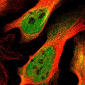 Anti-EP300 antibody produced in rabbit Ab1, Prestige Antibodies® Powered by Atlas Antibodies, affinity isolated antibody, buffered aqueous glycerol solution