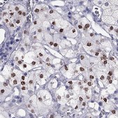 Anti-PHOX2A Prestige Antibodies® Powered by Atlas Antibodies, affinity isolated antibody