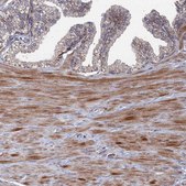Anti-GTF2IRD1 antibody produced in rabbit Prestige Antibodies® Powered by Atlas Antibodies, affinity isolated antibody, buffered aqueous glycerol solution