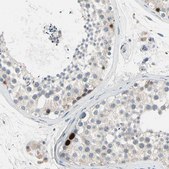 Anti-HJURP antibody produced in rabbit Prestige Antibodies® Powered by Atlas Antibodies, affinity isolated antibody, buffered aqueous glycerol solution
