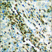 Anti-phospho-ICK (pTyr159) antibody produced in rabbit affinity isolated antibody