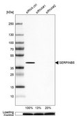 Anti-SERPINB5 antibody produced in rabbit Prestige Antibodies® Powered by Atlas Antibodies, affinity isolated antibody, buffered aqueous glycerol solution
