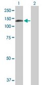 Anti-DDX24 antibody produced in mouse purified immunoglobulin, buffered aqueous solution