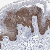 Anti-KRT14 antibody produced in rabbit Prestige Antibodies® Powered by Atlas Antibodies, affinity isolated antibody, buffered aqueous glycerol solution