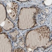 Anti-EIF2B2 antibody produced in rabbit Prestige Antibodies® Powered by Atlas Antibodies, affinity isolated antibody, buffered aqueous glycerol solution