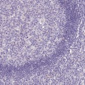 Anti-TINAGL1 antibody produced in rabbit Prestige Antibodies® Powered by Atlas Antibodies, affinity isolated antibody, buffered aqueous glycerol solution